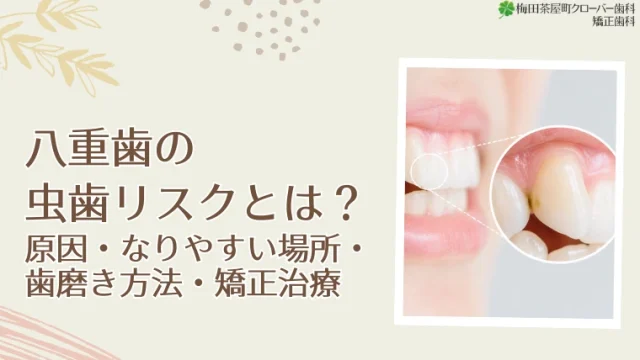なぜ八重歯は虫歯になりやすい？重なり合った歯の清掃リスクと予防法