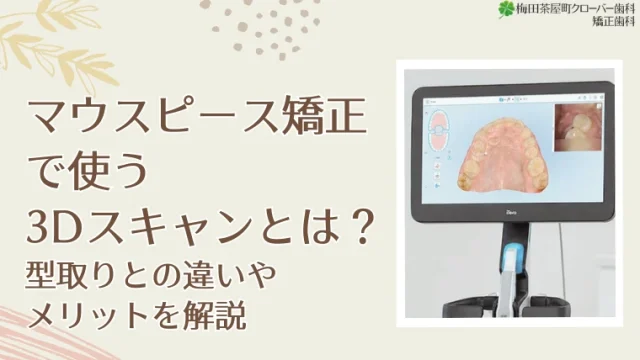 マウスピース矯正で使う3Dスキャンとは？型取りとの違いやメリットを解説
