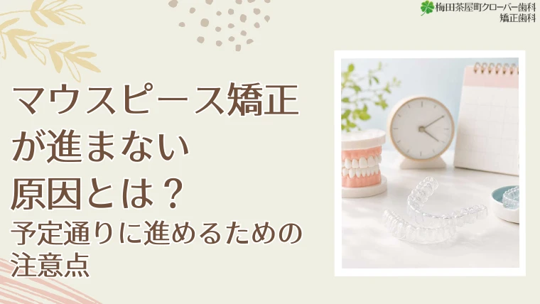 マウスピース矯正が進まない原因とは？予定通りに進めるための注意点