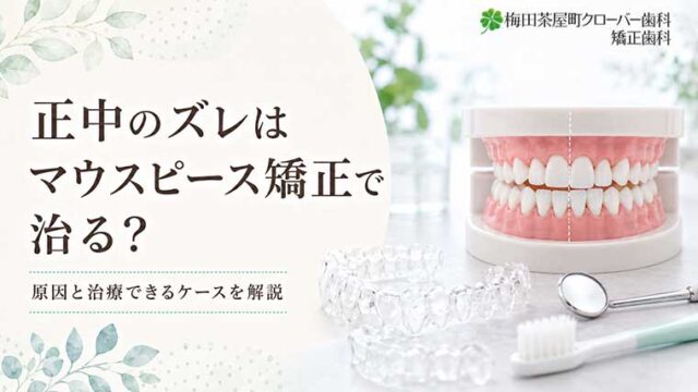 正中のズレはマウスピース矯正で治る？原因と治療できるケースを解説