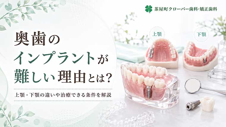 奥歯のインプラントが難しい理由とは？上顎・下顎の違いや治療できる条件を解説