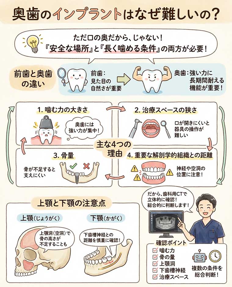 奥歯のインプラントはなぜ難しいの？の図解
