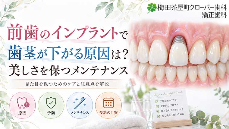 前歯のインプラントで歯茎が下がる原因は？美しさを保つメンテナンス