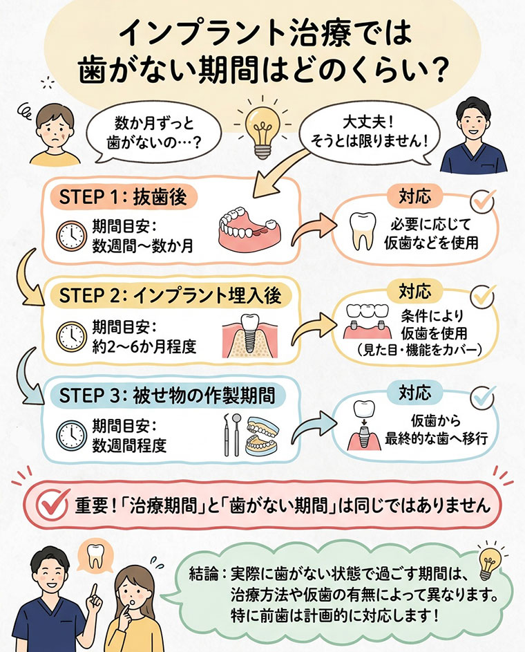 インプラント治療では歯がない期間はどのくらい？の図解