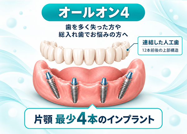 オールオン4のイメージ