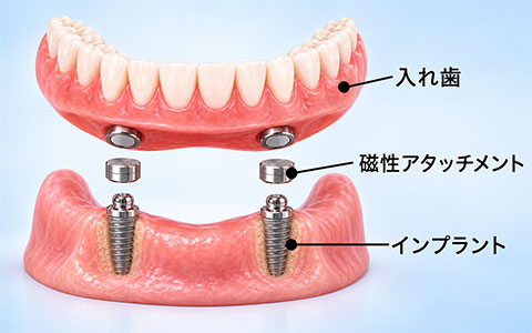 磁性アタッチメント