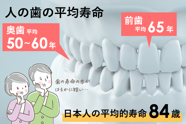 歯の寿命